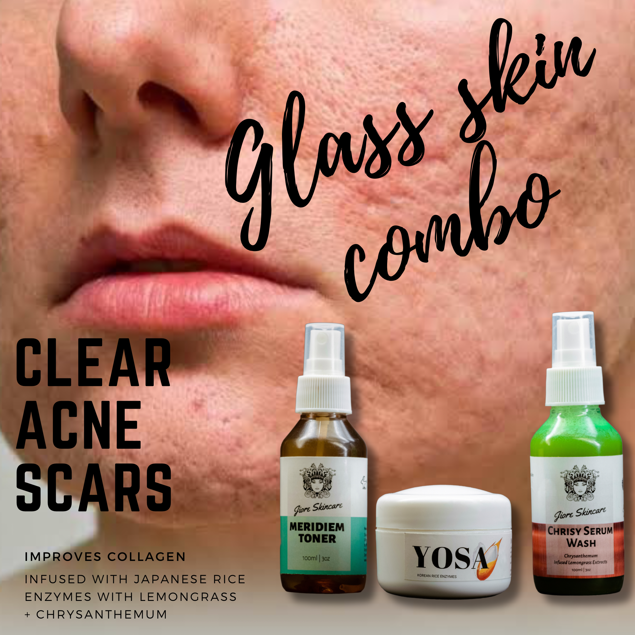 Glass Skin Combo
